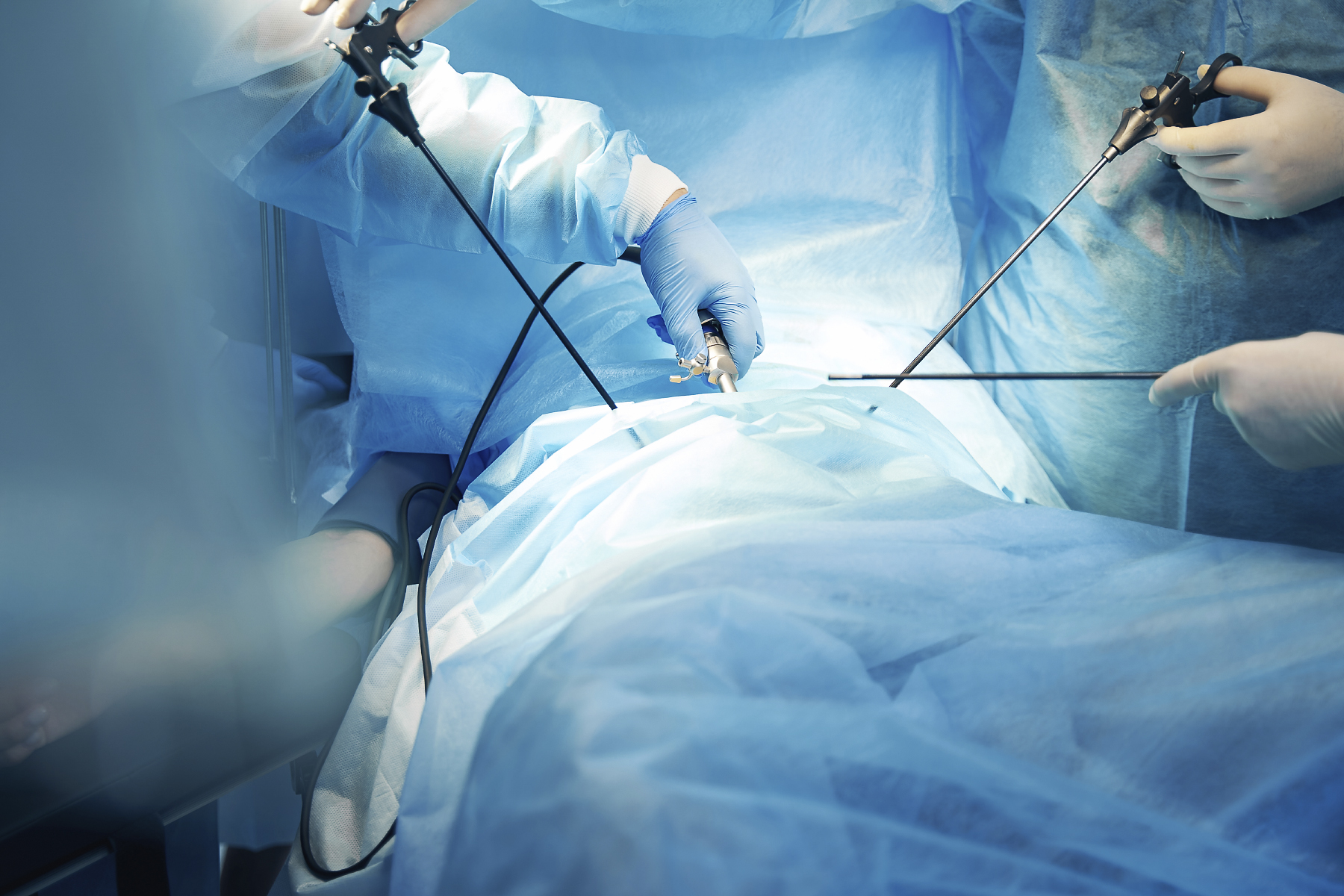 Mr Shiyam Nizar, The London Bowel Doctor, laparoscopic surgery at Frimley, Surrey, London